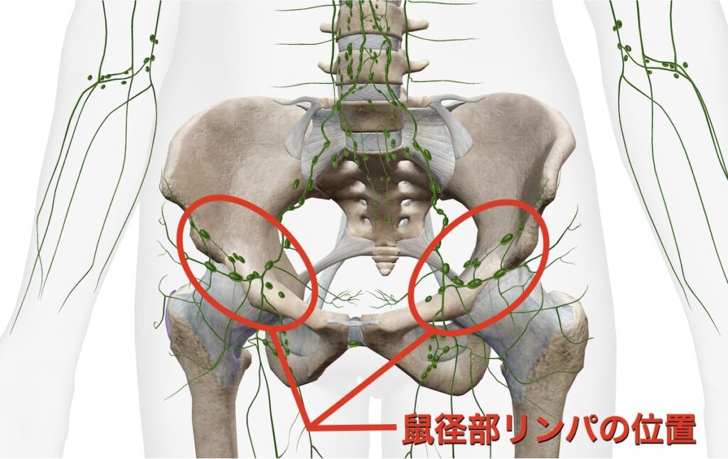 鼠径部リンパ