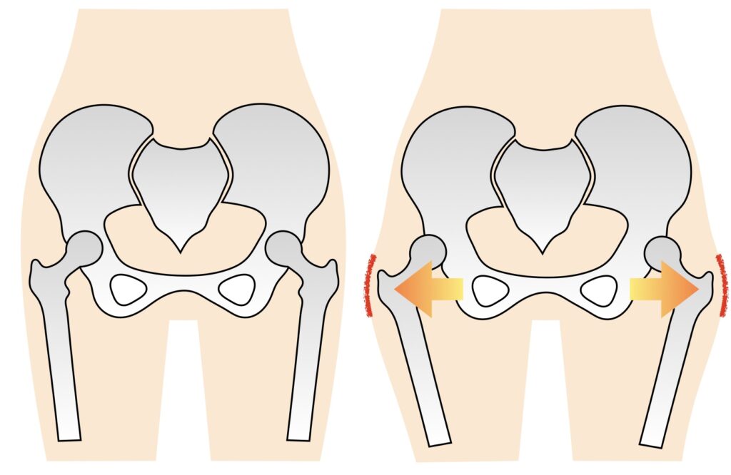 大転子の出っ張り
