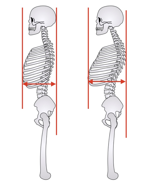 肋骨が出っ張る仕組み